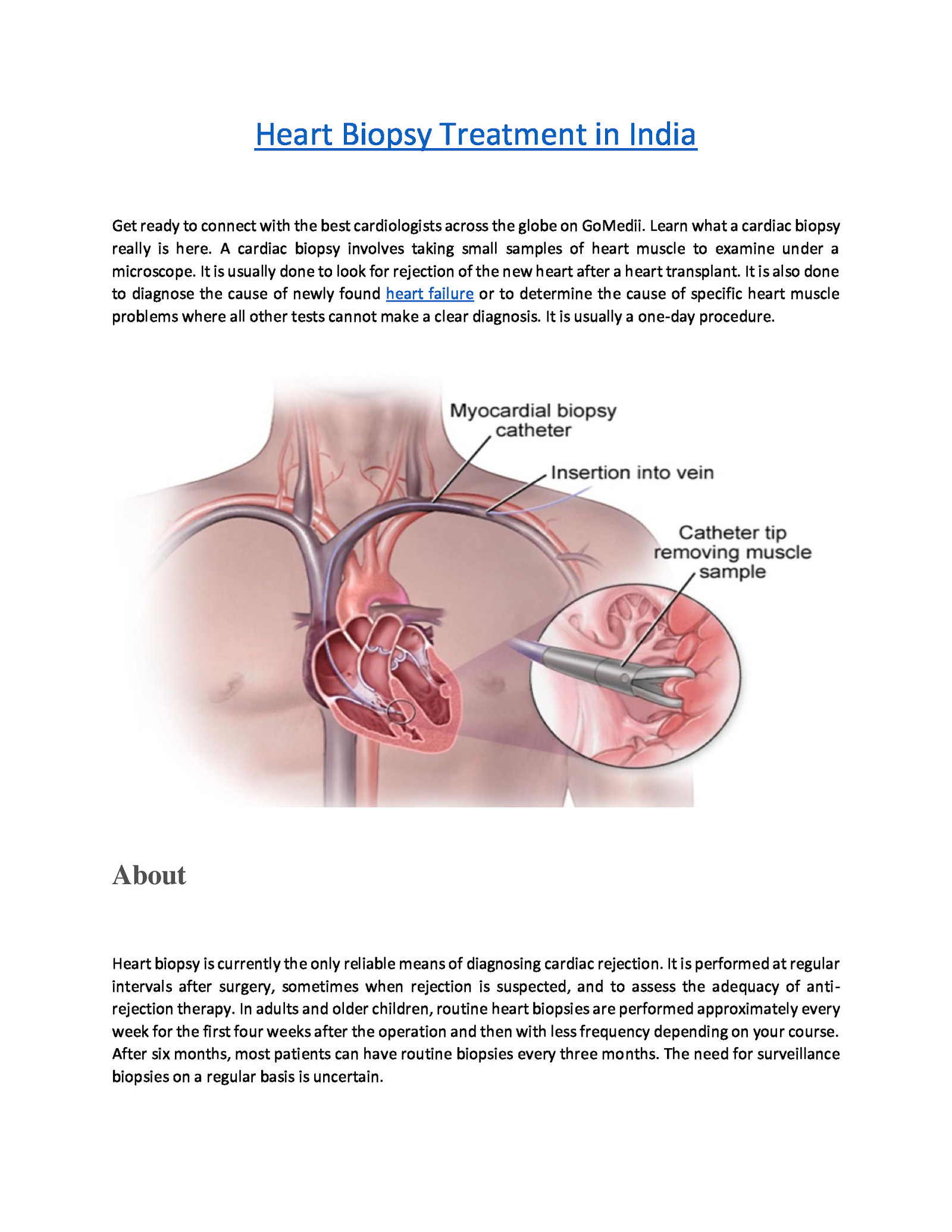 Heart Biopsy Treatment in India | GoMedii